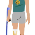 Limb Replacement: Can You Play Soccer with a Prosthetic Leg? 21 Limb Replacement: Can You Play Soccer with a Prosthetic Leg?